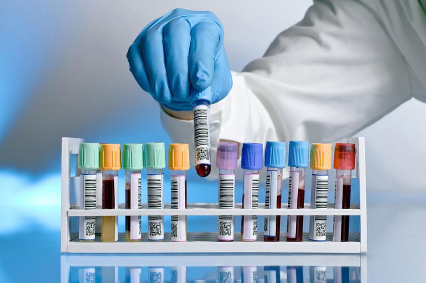  Rusya’da son 24 saatte 5 bin 65 yeni Coronavirus vakası